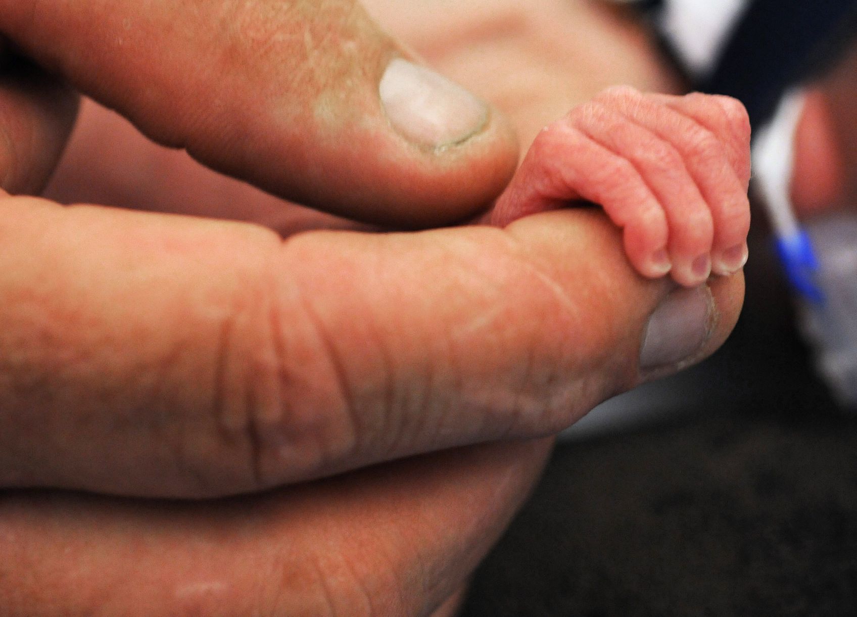 medical-cost-preemies-hand-ap.jpg